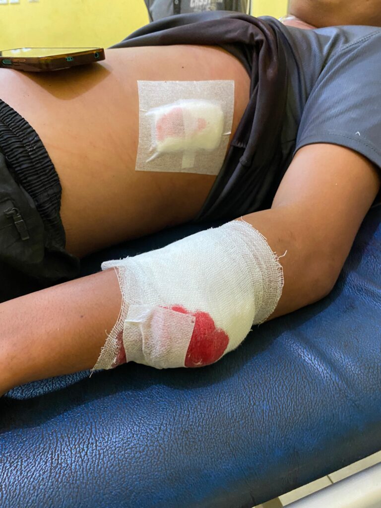 Tak Terima Ditegur, Pemuda Talang Pito Kepahiang Kena Tusuk