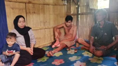 Kondisi Mengkhawatirkan! Korban Sengatan Listrik di Kepahiang Luka Bakar Makin Parah, Kapolres Turun Tangan